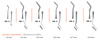 Filling instrument ergonomic handle NK-0