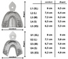 Impression tray with edge U1 perf.(upper) size XL